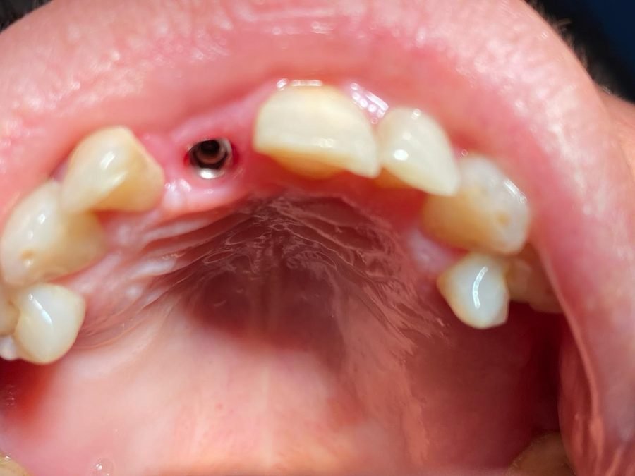 Rehabilitación dental completa