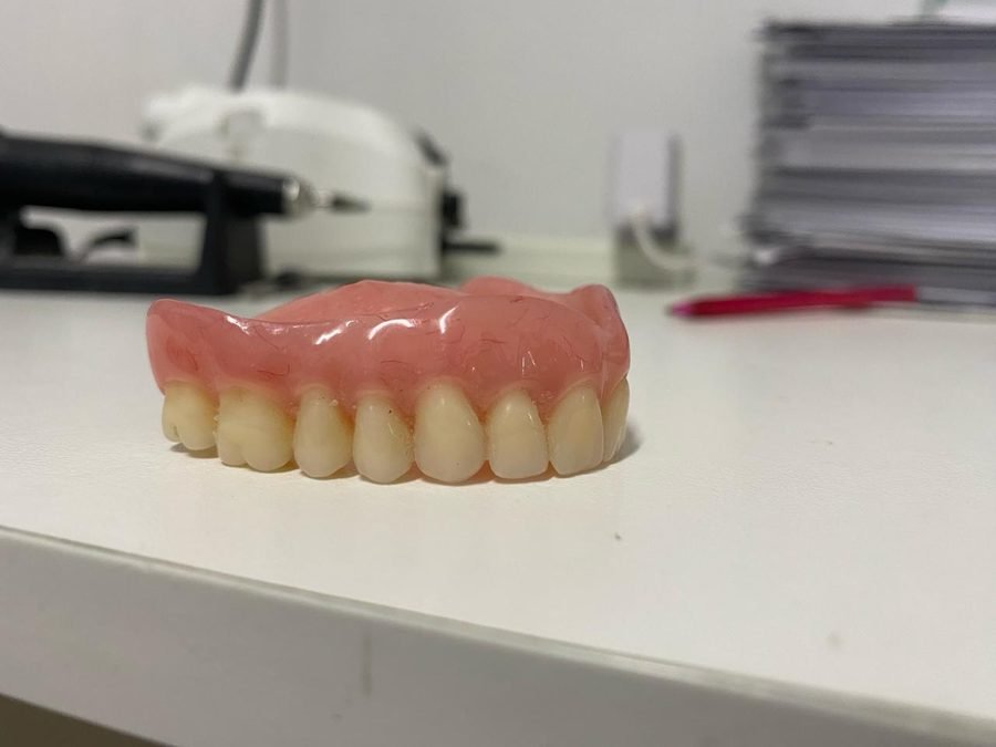 Prótesis total completa - Prótesis dental Derqui Pilar